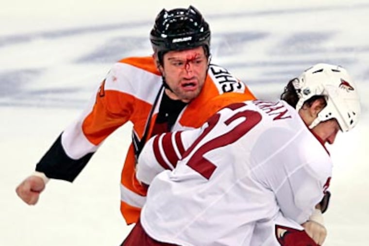 Jody Shelley got about 60 stitches after his fight with Phoenix's Nolan Yonkman. (Steven M. Falk/Staff Photographer)