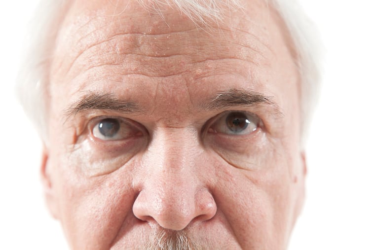 By the time most people turn 65 years old they will develop cataracts.