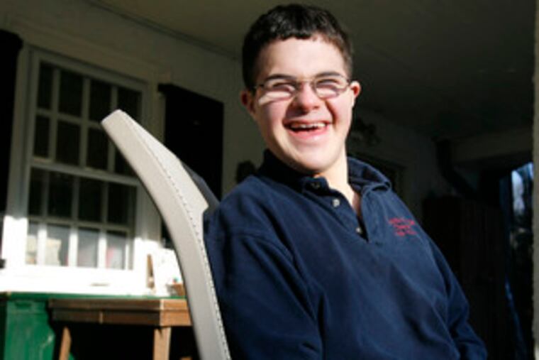 "I love being a star," Lior Liebling says. Liebling, who has Down syndrome, is the focus of a documentary.