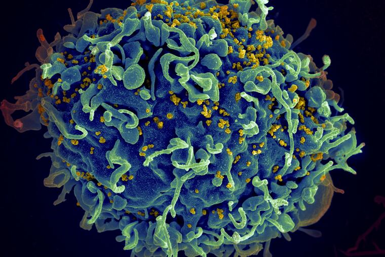 FILE - This electron microscope image made available by the U.S. National Institutes of Health shows a human T cell, in blue, under attack by HIV, in yellow, the virus that causes AIDS. A treatment that can prevent an HIV infection after exposure to the virus is being made more widely available in Philadelphia's suburban counties. (Seth Pincus, Elizabeth Fischer, Austin Athman/National Institute of Allergy and Infectious Diseases/NIH via AP)