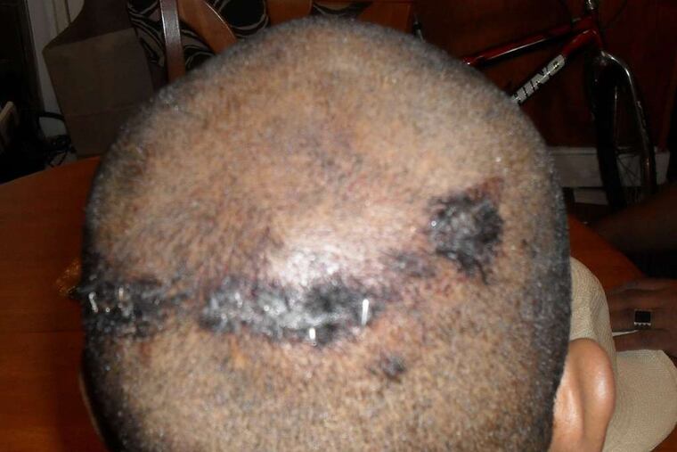 Askia Sabur faced a charge of assaulting police. He suffered a broken arm, head gashes, and bruises, his lawyer said.