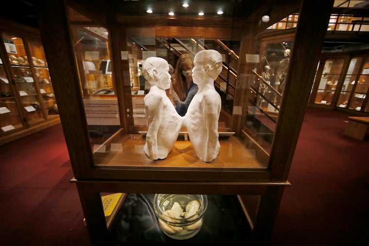 The cast and livers of Chang and Eng Bunker at The Mutter Museum of the College of Physicians of Philadelphia on Sept. 9, 2020. According to the museum website, these conjoined twins were born in what is now Thailand in 1811. They came to the United States in 1829 to tour and speak. Eventually tiring of life as touring performers, they married sisters and bought adjacent farms in North Carolina in the early 1840s. On display in the main Museum Gallery are their conjoined livers and the plaster death cast of their torsos.