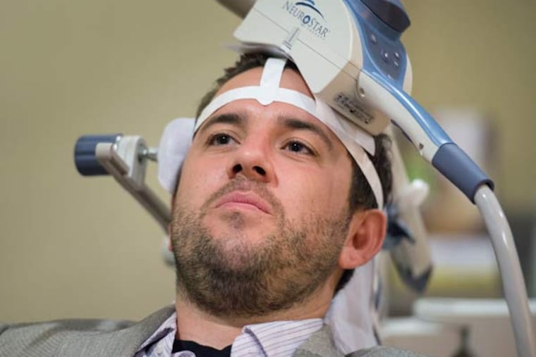 31-year-old Nicholas O'Madden, who suffers from anxiety and depression, receives treatment with Transcranial Magnetic Stimulation (TMS) therapy, which uses a large magnet to stimulate certain parts of the brain to alleviate depressive symptoms at TMS Health Solutions on July 2, 2015 in Sacramento, Calif. (Randy Pench/Sacramento Bee/TNS)