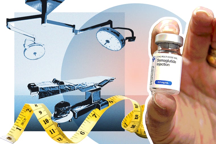 The volume of bariatric surgeries has fallen as the popularity of weight-loss drugs has grown.