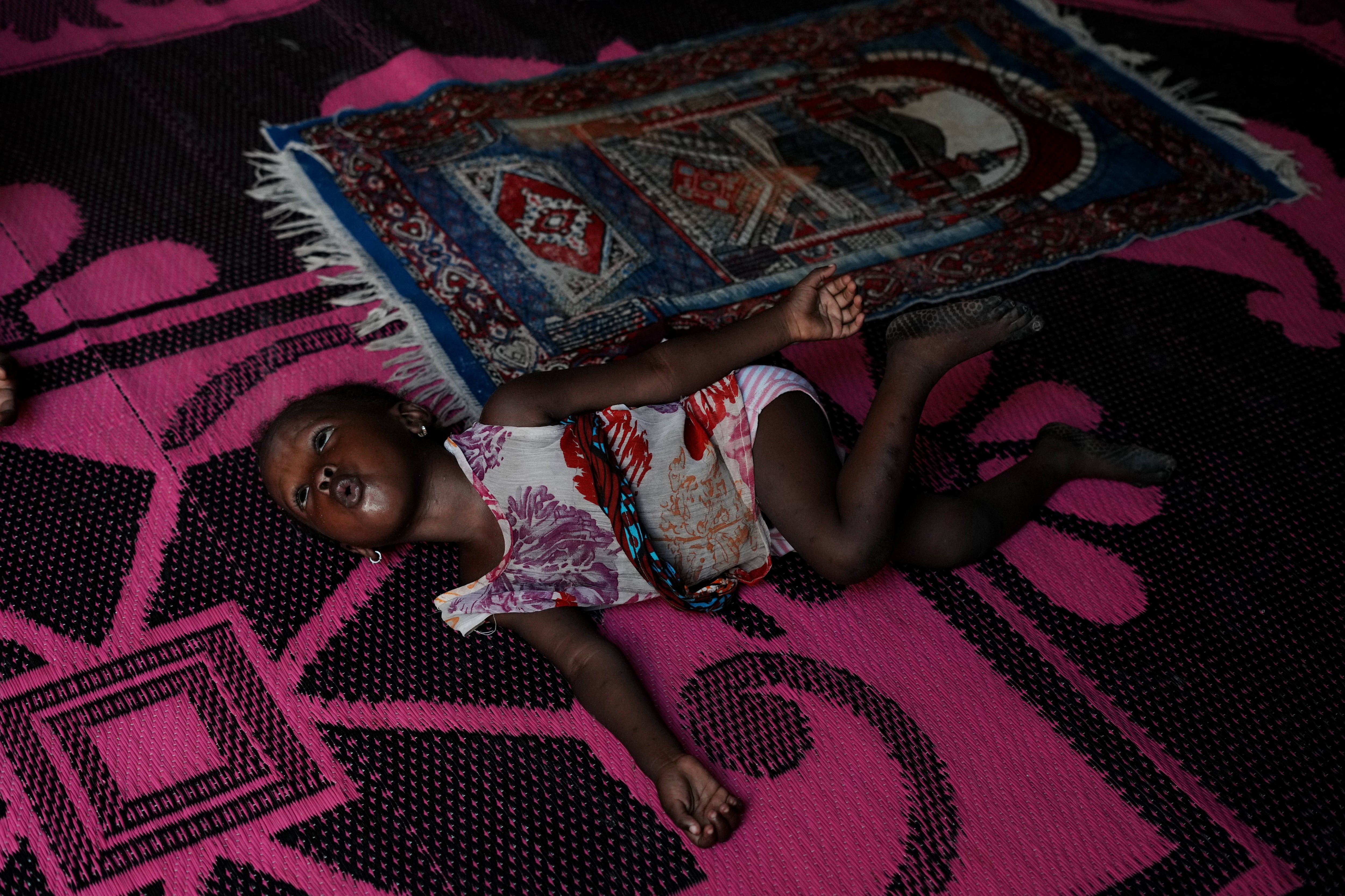 Nigerian children pay the price for the Iran war as malnutrition and poverty surge