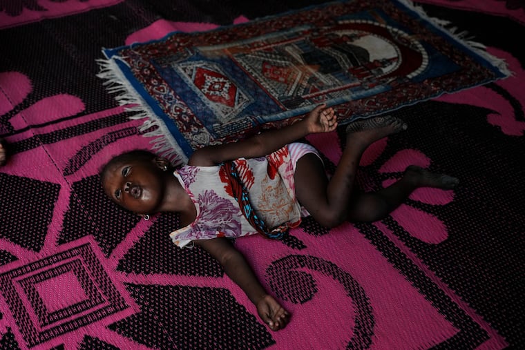 Farisa, who has relapsed into malnutrition, plays on a mat inside her house in Kware Sokoto, northwestern Nigeria, Wednesday, July 15, 2026.