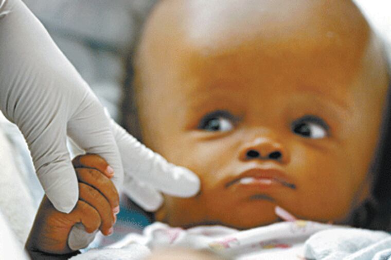 Naphtalie Bazile, a 10-month-old Haitian girl with hydrocephalus, holds the hand of Sovie Leah, a student nurse anesthetist, before surgery at Thomas Jefferson University Hospital. (Michael S. Wirtz / Inquirer Staff Photographer