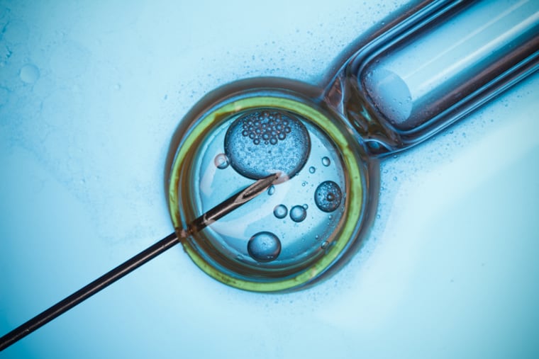 In vitro fertilization