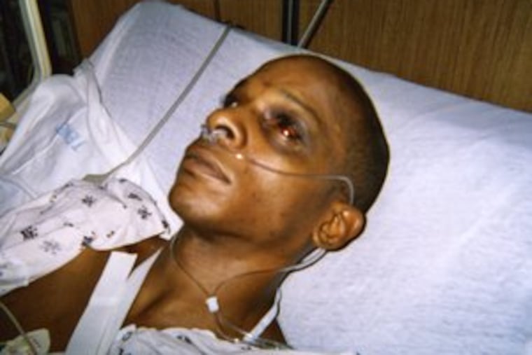 Kyle Byrd , 36, was hospitalized three times while in custody, according to his lawyer, Cary McClain. He said he intends to sue the officers involved.