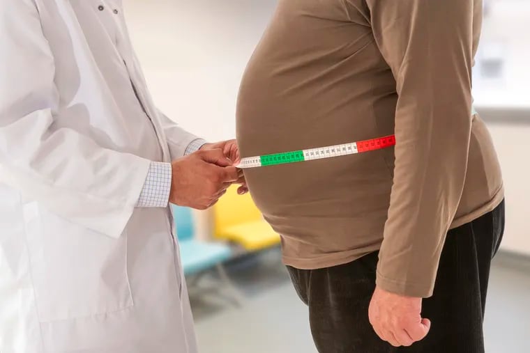 Researchers have found a genetic predisposition for obesity.