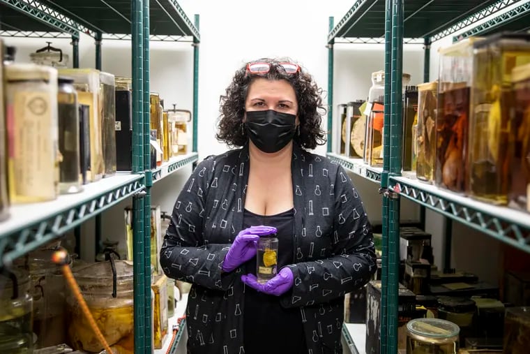 Mutter Museum curator Anna N. Dhody holds a piece of intestine from a patient who died of cholera in 1849. She coauthored a study on how the bacteria that cause cholera have evolved.