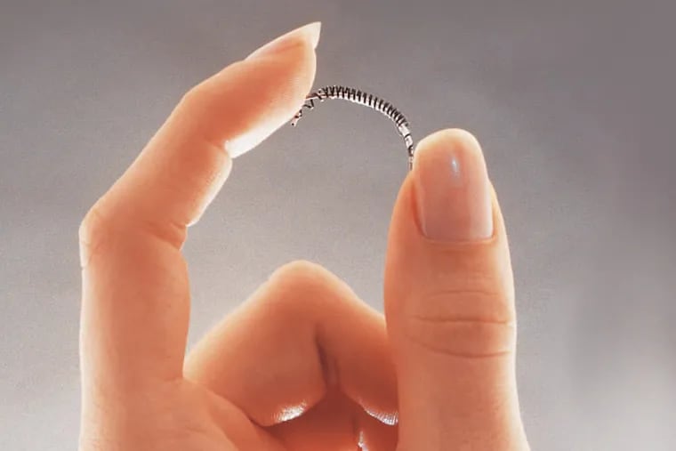 Essure is a tiny coil that is inserted in a woman’s fallopian tube to create scarring that blocks it.