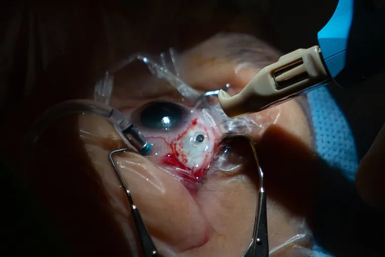 The drug delivery device is implanted in a tiny pocket in the eye.