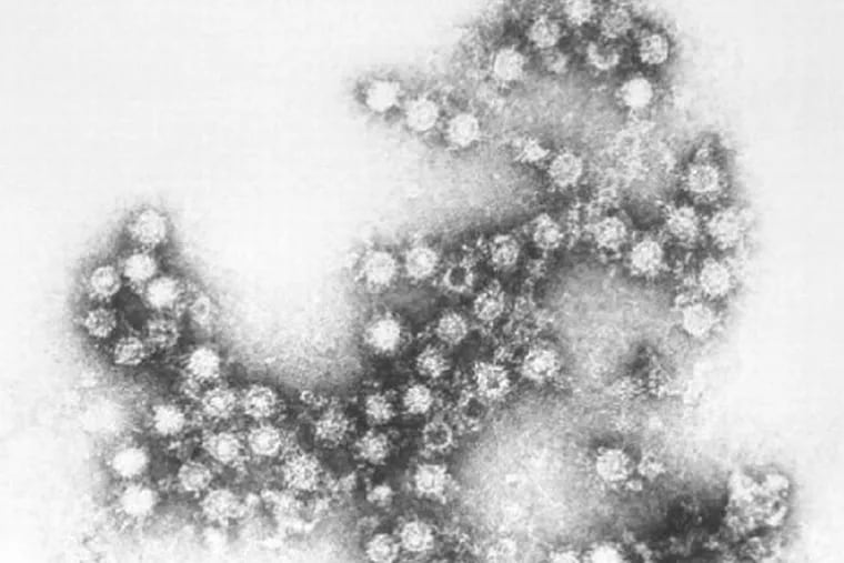 Health officials have detected a virus called enterovirus D68 in many patients afflicted with a condition called acute flaccid myelitis, which is marked by muscle weakness or paralysis in at least one limb.