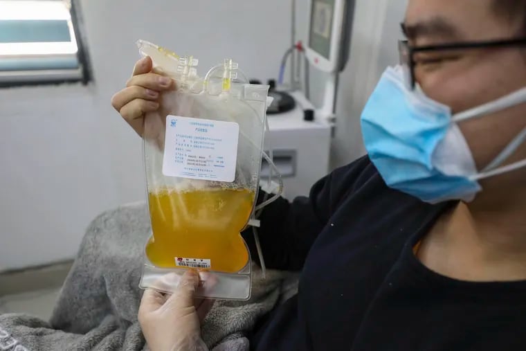 Dr. Zhou Min, a recovered COVID-19 patient who has passed his 14-day quarantine, donates plasma in the city's blood center in Wuhan in central China's Hubei province. Plasma from recovered COVID-19 patients contains antibodies that may help reduce the viral load in patients that are fighting the disease.