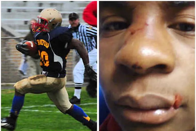 Jeffione Thomas, scoring a touchdown, left, and shown right with evidence of what he claims was an uncalled-for attack by school police officers.