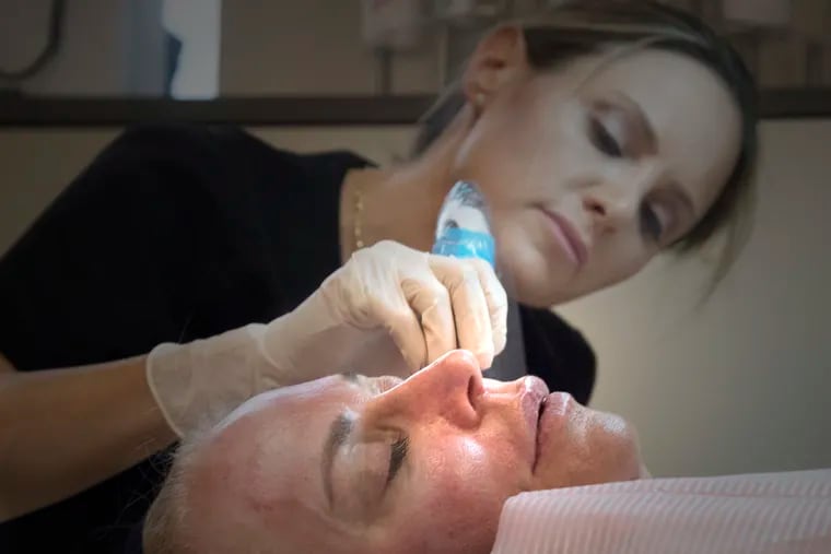 Lisa Ravitz, an aesthetician, performs a microneedling procedure on Sheryl Schreiber at Jefferson Health in Philadelphia, Pa. Wednesday, July 18, 2018.