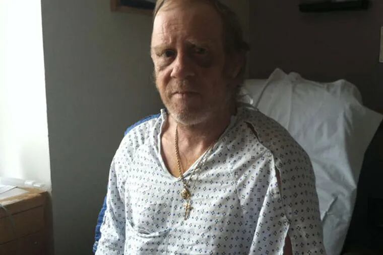 Cab driver Peter Deforge in his room at Hospital of the University of Pennsylvania, where he was treated after robbery. (Morgan Zalot / Staff)